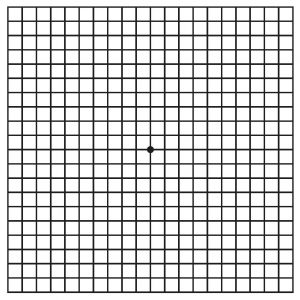 Amsler Grid