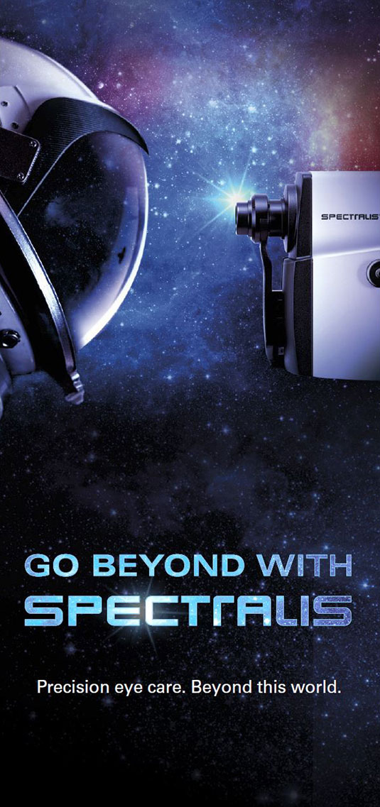 Patient Flyer Go Beyond with SPECTRALIS