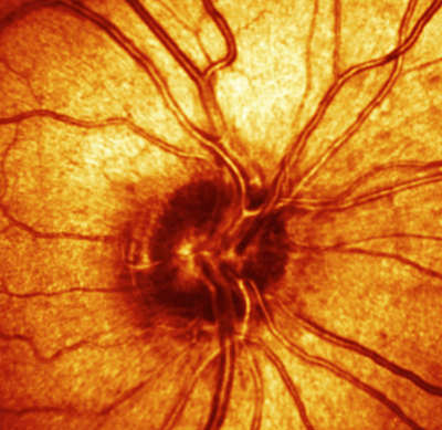 HRT of a healthy optic nerve head