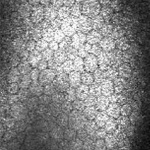 Endothelium at 572µm