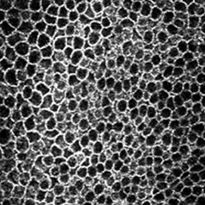 Epithelium at 30µm