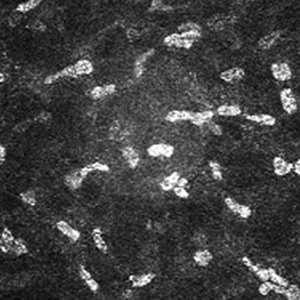 Stroma at 300µm